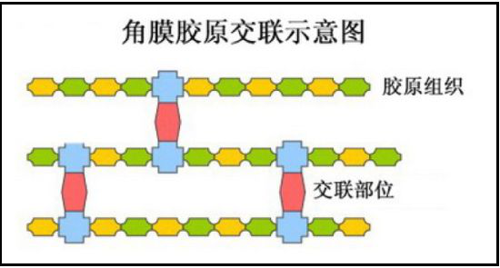 眼表眼角膜,?，斎鹨曆劭?上海眼科醫(yī)院