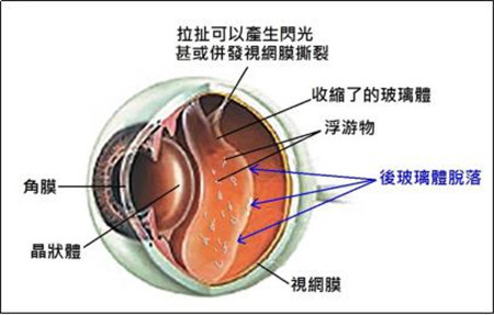 玻璃體視網(wǎng)膜,希瑪瑞視眼科,上海眼科醫(yī)院