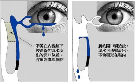 眼眶病,希瑪瑞視眼科,上海眼科醫(yī)院