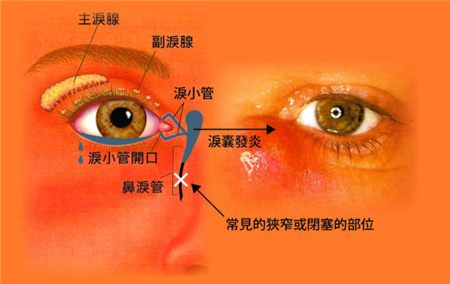 眼眶病,希瑪瑞視眼科,上海眼科醫(yī)院