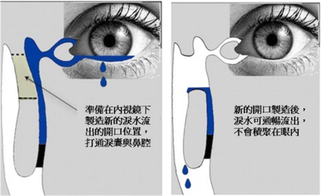 眼眶病,?，斎鹨曆劭?上海眼科醫(yī)院