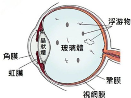 玻璃體視網(wǎng)膜,希瑪瑞視眼科,上海眼科醫(yī)院