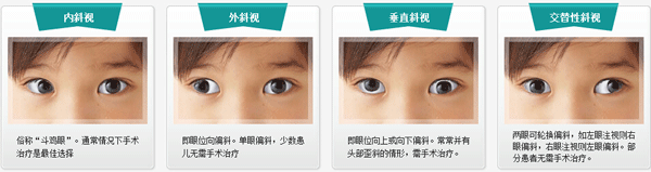 小兒眼病,?，斎鹨曆劭?上海眼科醫(yī)院