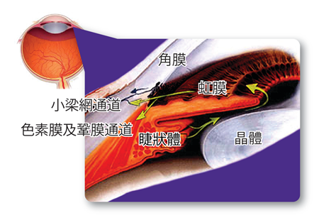 青光眼,?，斎鹨曆劭?上海眼科醫(yī)院