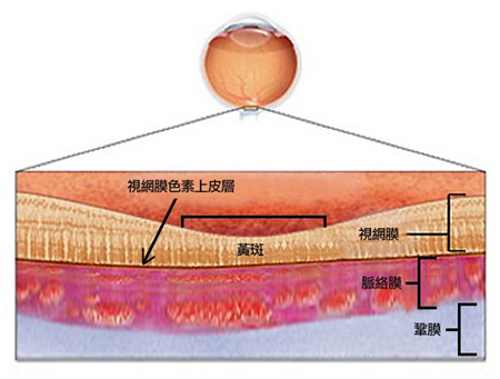 玻璃體視網(wǎng)膜,?，斎鹨曆劭?上海眼科醫(yī)院