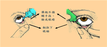 眼表眼角膜,?，斎鹨曆劭?上海眼科醫(yī)院