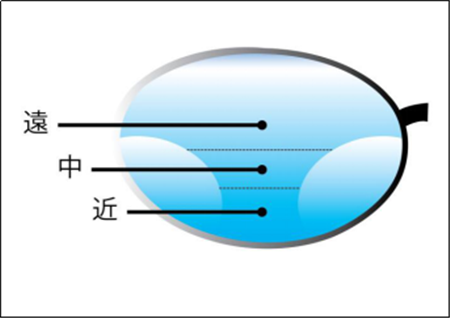 屈光矯視,?，斎鹨曆劭?上海眼科醫(yī)院