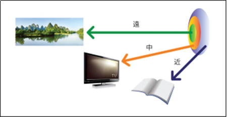 屈光矯視,?，斎鹨曆劭?上海眼科醫(yī)院