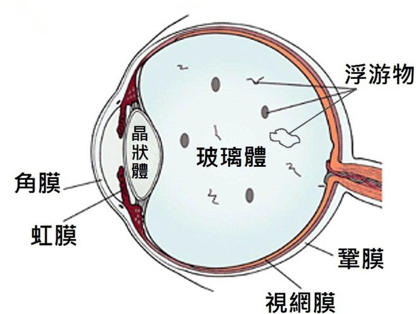玻璃體視網(wǎng)膜,希瑪瑞視眼科,上海眼科醫(yī)院