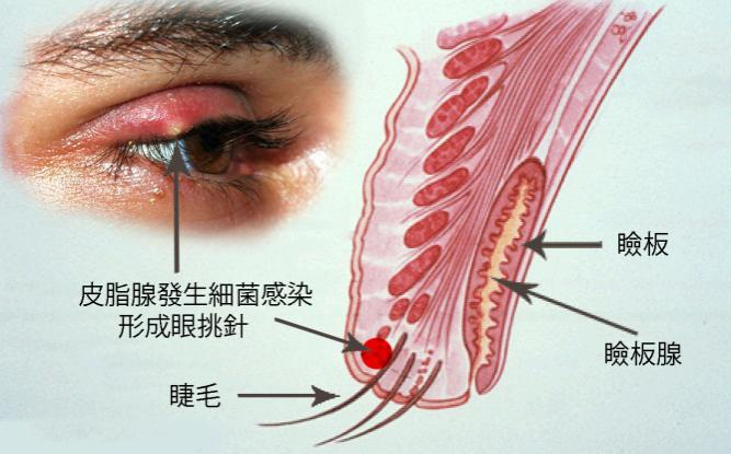 眼表眼角膜,希瑪瑞視眼科,上海眼科醫(yī)院