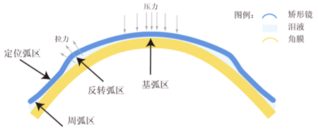 醫(yī)學驗光配鏡,?，斎鹨曆劭?上海眼科醫(yī)院